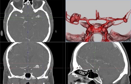 3D Viewer for Medical